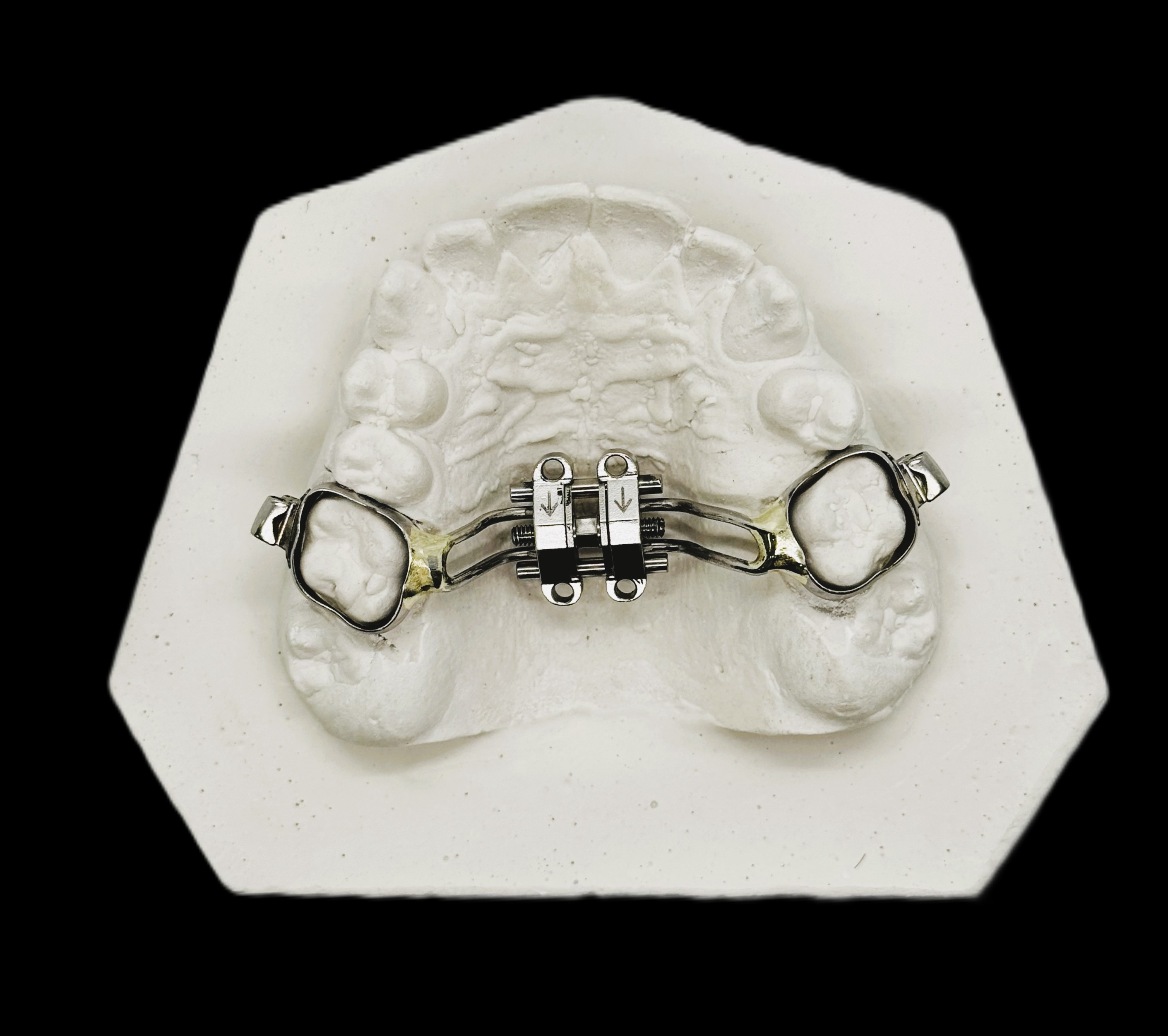 Все аппараты