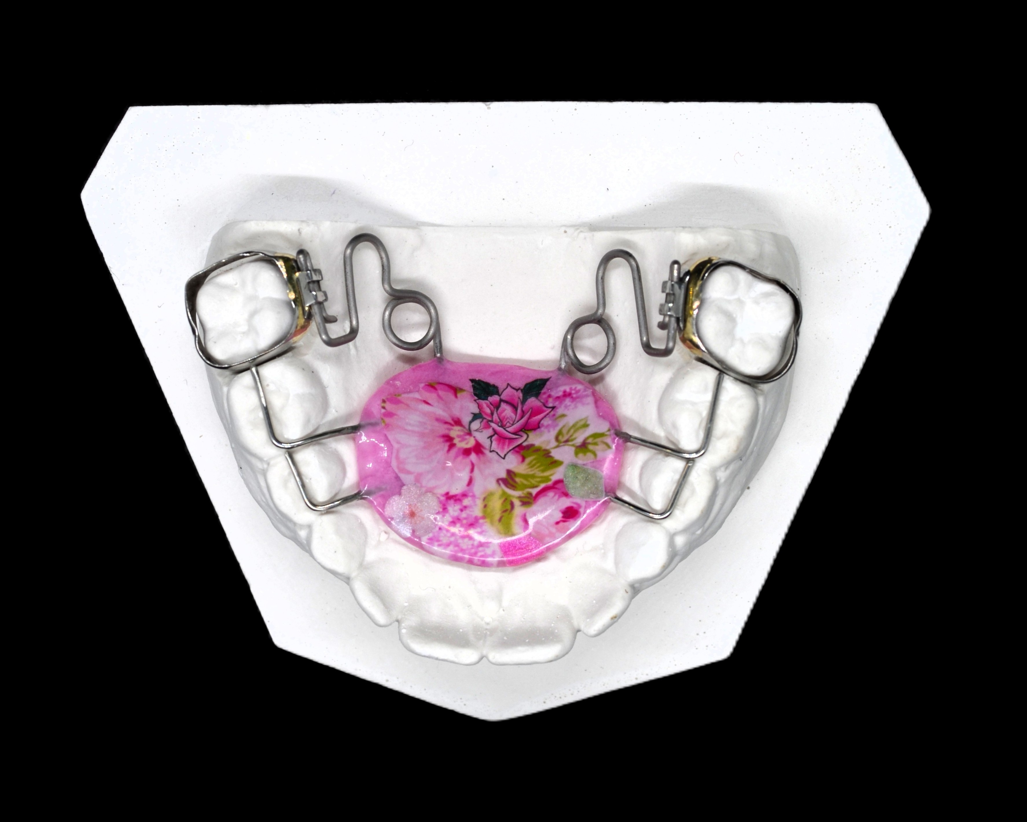 Аппарат Пендюлюм (Pendilum)