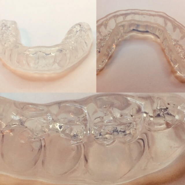 Все аппараты