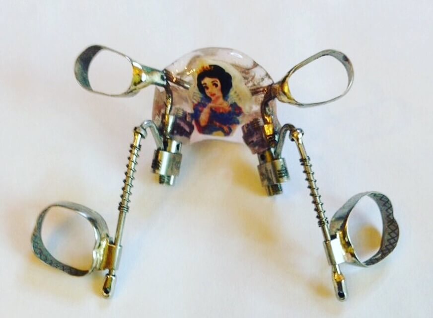 Аппарат Фаст-бек от Леоне