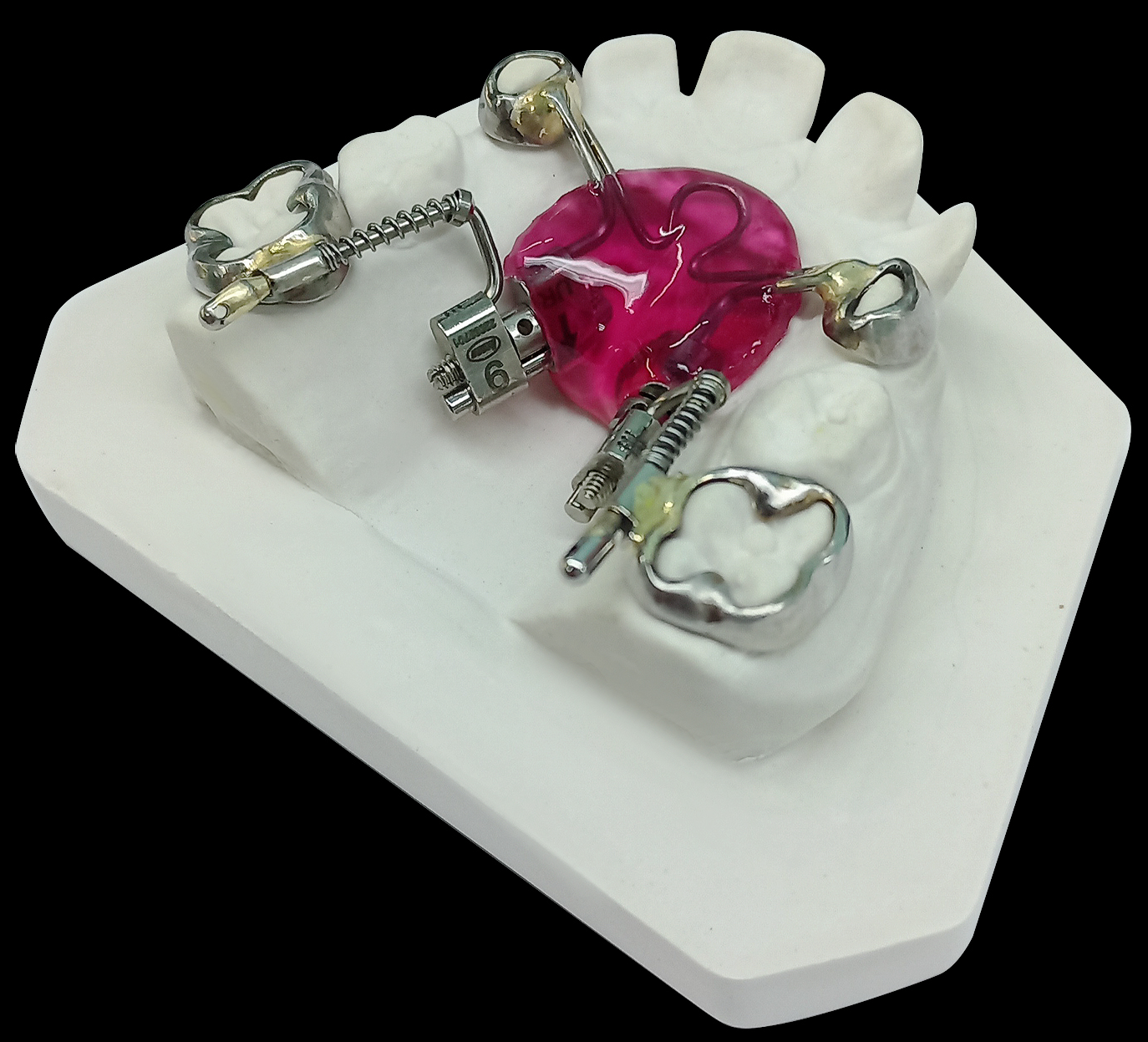 Аппарат Фаст-бек от Леоне