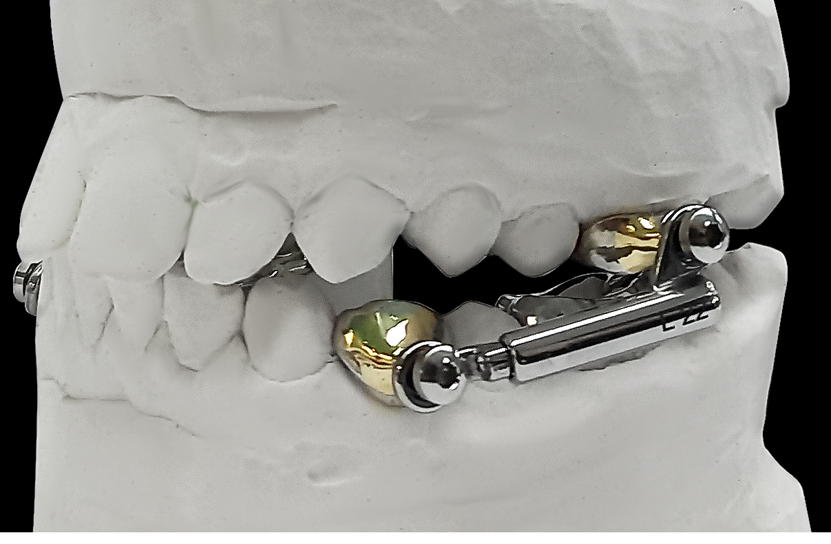 Все аппараты