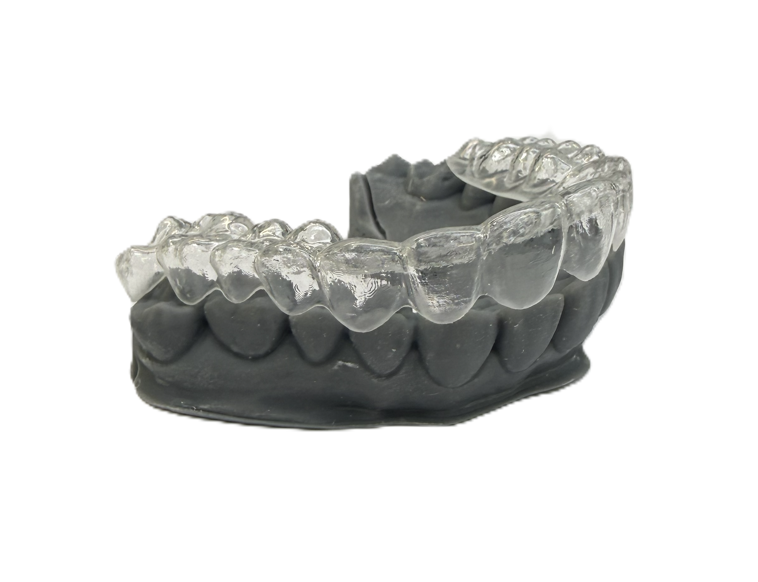 Дизайн ретенционной каппы