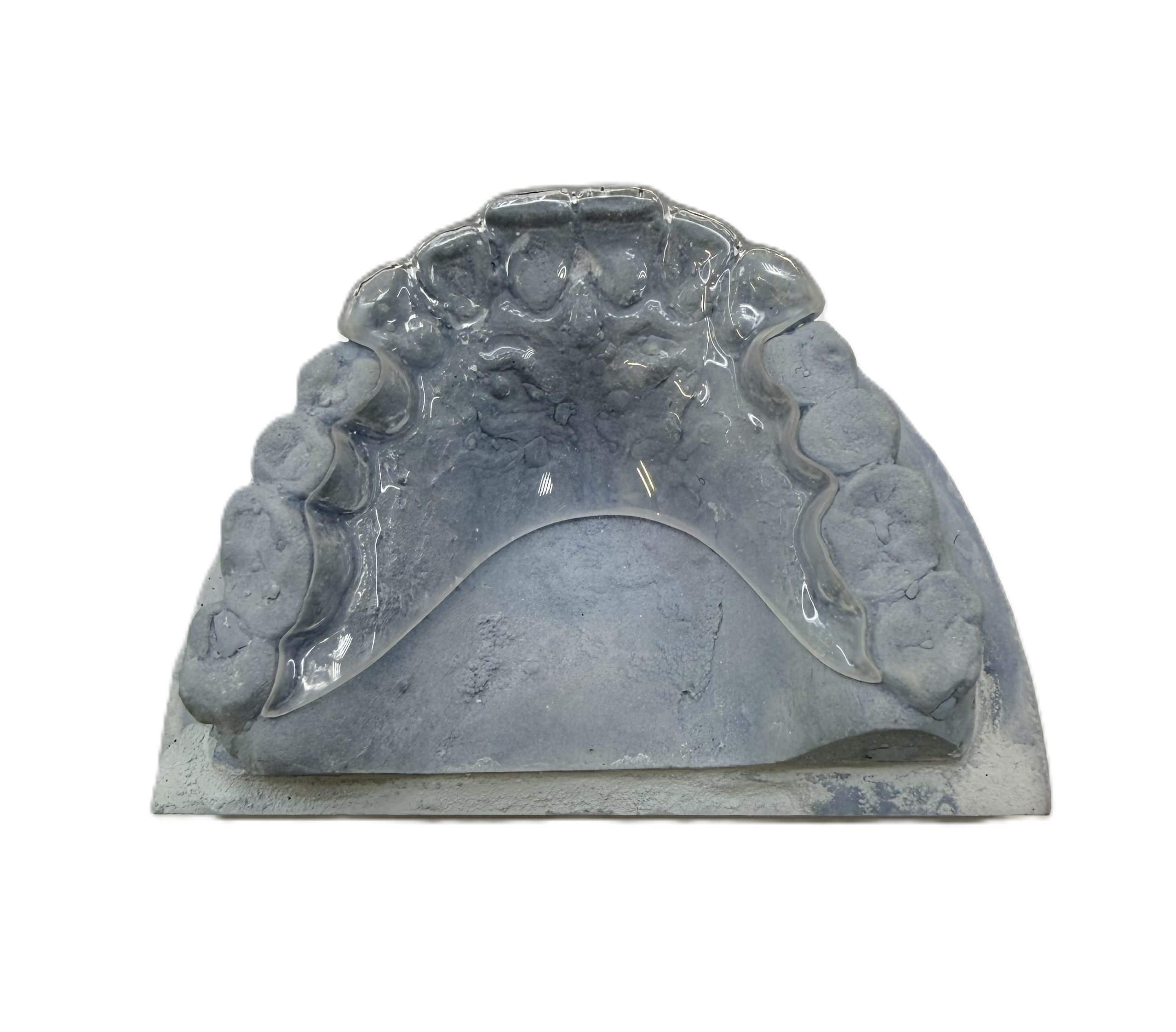 Дизайн ретенционной каппы